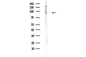 Western blot analysis of lysates from F10-LUC cells(heat-shock,45 min treatment), using PTPN22 Antibody at 1/1000 dilution.