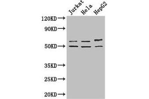 Western Blot Positive WB detected in: Jurkat whole cell lysate, Hela whole cell lysate, HepG2 whole cell lysate All lanes: YTHDF2 antibody at 2. (YTHDF2 Antikörper  (AA 201-500))