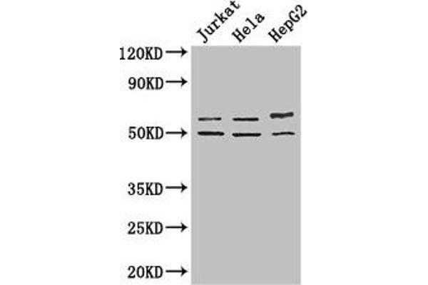 YTHDF2 Antikörper  (AA 201-500)