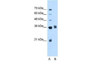 WB Suggested Anti-TFB1M  Antibody Titration: 2. (TFB1M Antikörper  (Middle Region))