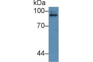 Detection of ICAM1 in Human dog liver cell lysate using Polyclonal Antibody to Intercellular Adhesion Molecule 1 (ICAM1) (ICAM1 Antikörper  (AA 25-531))