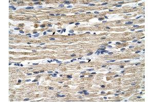 GSTM2 antibody was used for immunohistochemistry at a concentration of 4-8 ug/ml to stain Skeletal muscle cells (arrows) in Human Muscle.