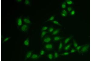 Immunofluorescence analysis of U2OS cells using SSRP1 Polyclonal Antibody (SSRP1 Antikörper)