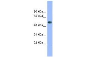 Image no. 1 for anti-serine Peptidase Inhibitor, Kunitz Type 1 (SPINT1) (AA 395-444) antibody (ABIN6743332) (SPINT1 Antikörper  (AA 395-444))