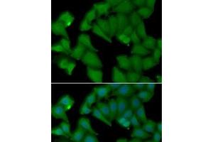 Immunofluorescence analysis of MCF7 cells using HBA1 Polyclonal Antibody (HBA1 Antikörper)