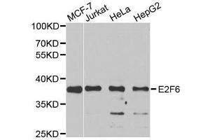 Western blot analysis of extracts of various cell lines, using E2F6 antibody. (E2F6 Antikörper)