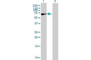 Western Blot analysis of CACNB3 expression in transfected 293T cell line by CACNB3 MaxPab polyclonal antibody. (CACNB3 Antikörper  (AA 1-484))