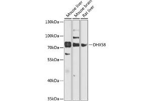 Western blot analysis of extracts of various cell lines, using DHX58 antibody (ABIN6129372, ABIN6139609, ABIN6139610 and ABIN6224272) at 1:1000 dilution. (DHX58 Antikörper  (AA 389-678))