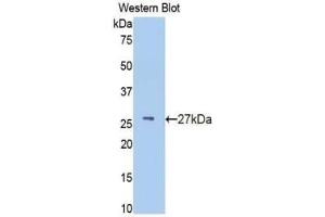 Western blot analysis of recombinant Human IFNa/bR1. (IFNAR1 Antikörper  (AA 28-227))