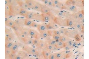 Detection of CCND2 in Human Liver Tissue using Polyclonal Antibody to Cyclin D2 (CCND2) (Cyclin D2 Antikörper  (AA 68-278))