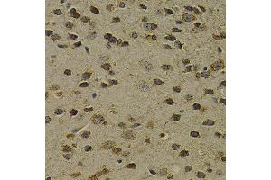 Immunohistochemistry (IHC) image for anti-8-Oxoguanine DNA Glycosylase (OGG1) (AA 1-345) antibody (ABIN3021937) (OGG1 Antikörper  (AA 1-345))