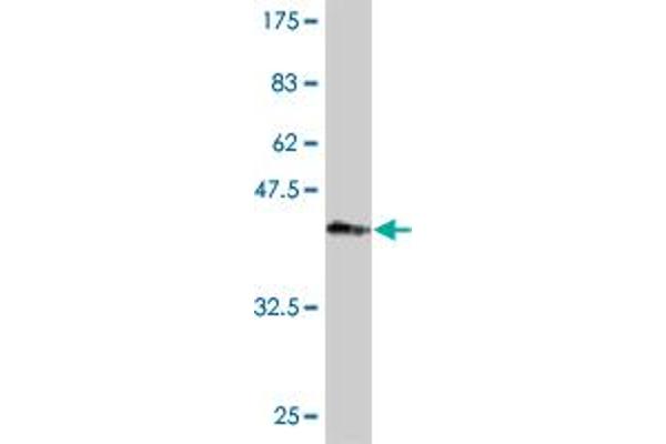 Plakophilin 4 Antikörper  (AA 12-110)