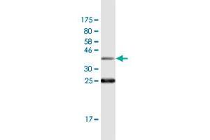 Western Blot detection against Immunogen (36. (SSH1 Antikörper  (AA 950-1049))