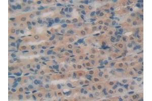 DAB staining on IHC-P; Samples: Rat Intestine Tissue (RNASE1 Antikörper  (AA 26-152))
