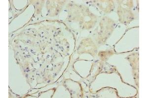 Immunohistochemistry of paraffin-embedded human kidney tissue using ABIN7176389 at dilution of 1:100 (ZNF563 Antikörper  (AA 214-476))