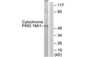 Western blot analysis of extracts from 293 cells, using Cytochrome P450 19A1 Antibody. (Aromatase Antikörper  (AA 221-270))