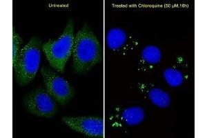 Fluorescent image of U251 cells stained with anti-ATG5 antibody diluted at 1:25 dilution. (ATG5 Antikörper  (AA 209-238))