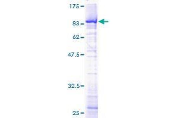 TOE1 Protein (AA 1-510) (GST tag)