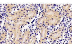Detection of IFNa in Mouse Kidney Tissue using Polyclonal Antibody to Interferon Alpha (IFNa) (IFNA Antikörper  (AA 24-189))