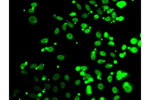 Immunofluorescence analysis of A549 cells using FIP1L1 antibody. (FIP1L1 Antikörper)