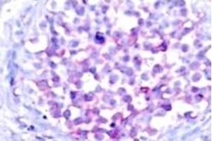 Image no. 2 for anti-V-Raf-1 Murine Leukemia Viral Oncogene Homolog 1 (RAF1) (pSer259) antibody (ABIN318109) (RAF1 Antikörper  (pSer259))