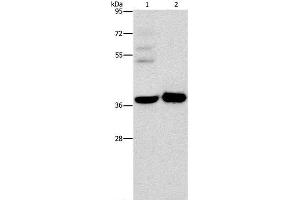 Western Blotting (WB) image for anti-serpin Peptidase Inhibitor, Clade E (Nexin, Plasminogen Activator Inhibitor Type 1), Member 2 (SERPINE2) antibody (ABIN7240172)