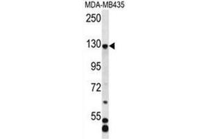 C7orf63 Antibody (N-term) western blot analysis in MDA-MB435 cell line lysates (35µg/lane). (C7orf63 Antikörper  (N-Term))