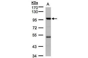 WB Image Sample(30 ug whole cell lysate) A:Hep G2 , 7. (KAT2B Antikörper  (C-Term))