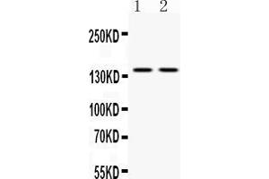 Western blot analysis of CASR expression in HELA whole cell lysates ( Lane 1) and  22RV1 whole cell lysates ( Lane 2). (CASR Antikörper  (AA 926-1078))