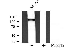 Western blot analysis of PI3 kinase P110α expression in rat liver (PIK3CA Antikörper  (Internal Region))