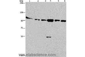 Western blot analysis of Human testis tissue, K562, A549, Raji, NIH/3T3 and Hela cell, using PRKD3 Polyclonal Antibody at dilution of 1:200 (PRKD3 Antikörper)
