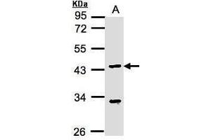 WB Image Sample(30 ug whole cell lysate) A:MOLT4 , 10% SDS PAGE antibody diluted at 1:1000 (KLF15 Antikörper  (N-Term))