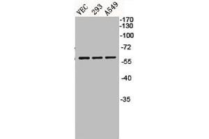 Western Blot analysis of VEC 293 A549 cells using BMP-5 Polyclonal Antibody (BMP5 Antikörper  (Internal Region))
