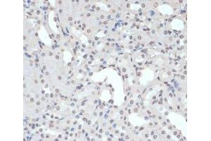 Immunohistochemistry of paraffin-embedded Mouse kidney using Phospho-Jak2(Y1007/1008) Polyclonal Antibody at dilution of 1:200 (40x lens). (JAK2 Antikörper  (pTyr1007, pTyr1008))