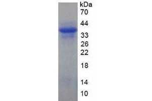 SDS-PAGE analysis of Human Keratin 10 Protein. (Keratin 10 Protein (KRT10))