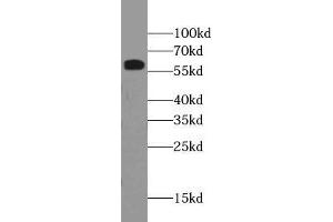 WB analysis of HEK293T cells subjected to SDS-PAGE, using RBM39 antibody (1/500 dilution). (RBM39 Antikörper)