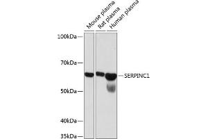 Western blot analysis of extracts of various cell lines, using SERPINC1 Rabbit mAb (ABIN7270208) at 1:1000 dilution. (SERPINC1 Antikörper)