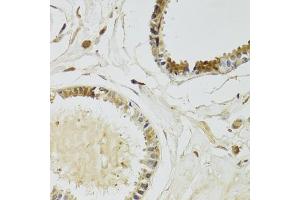 Immunohistochemistry of paraffin-embedded human breast using KLK10 Antibody (ABIN6142943) at dilution of 1:100 (40x lens). (Kallikrein 10 Antikörper  (AA 35-276))