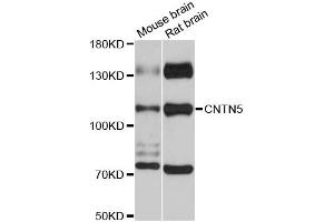 Western blot analysis of extracts of various cell lines, using CNTN5 antibody (ABIN6290256) at 1:3000 dilution. (Contactin 5 Antikörper)