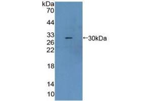 Western blot analysis of recombinant Mouse CBR1. (CBR1 Antikörper  (AA 66-271))