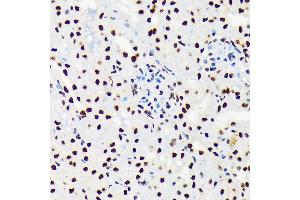 Immunohistochemistry (IHC) image for anti-DEAD (Asp-Glu-Ala-Asp) Box Polypeptide 39B (DDX39B) antibody (ABIN7266696)