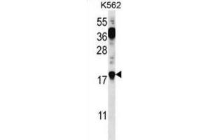 Western Blotting (WB) image for anti-Parathymosin (PTMS) antibody (ABIN2996966)