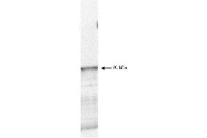 Western blot using  affinity purified anti-PDK-1 antibody shows detection of myc-tagged human PDK-1 at 60kDa in ~10 µg of a virus infected Sf9 cell lysate (arrow). (PDPK1 Antikörper  (C-Term))