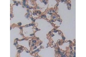 IHC-P analysis of Kidney tissue, with DAB staining. (TLR8 Antikörper  (AA 519-812))