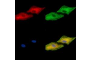 anti-Calmin (CLMN) antibody