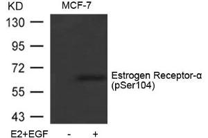 Western blot analysis of extracts from MCF-7 cells untreated or treated with E2 and EGF using Estrogen Receptor-a(Phospho-Ser104) Antibody (Estrogen Receptor alpha Antikörper  (pSer104))