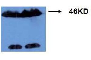 Western Blotting (WB) image for anti-Microtubule-Associated Protein tau (MAPT) (AA 177-187), (pThr181) antibody (ABIN1108155) (MAPT Antikörper  (pThr181))