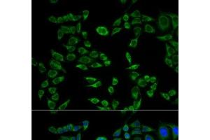 Immunofluorescence analysis of HeLa cells using VAPB Polyclonal Antibody (VAPB Antikörper)