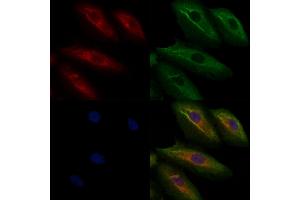 ABIN6260291 and ABIN6276897 staining  cells by IF/ICC.