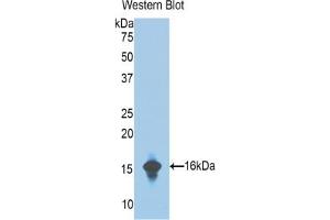 Western blot analysis of the recombinant protein. (Complement Factor B Antikörper  (AA 476-592))